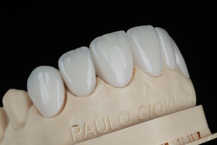 difusores para flashes