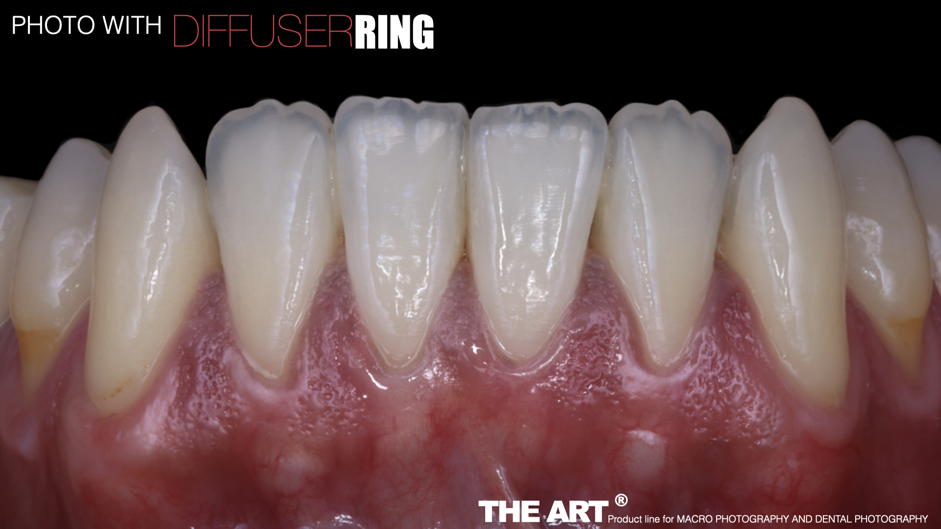 The Art®️ Diffuser Ring V.2 - Imagen 8