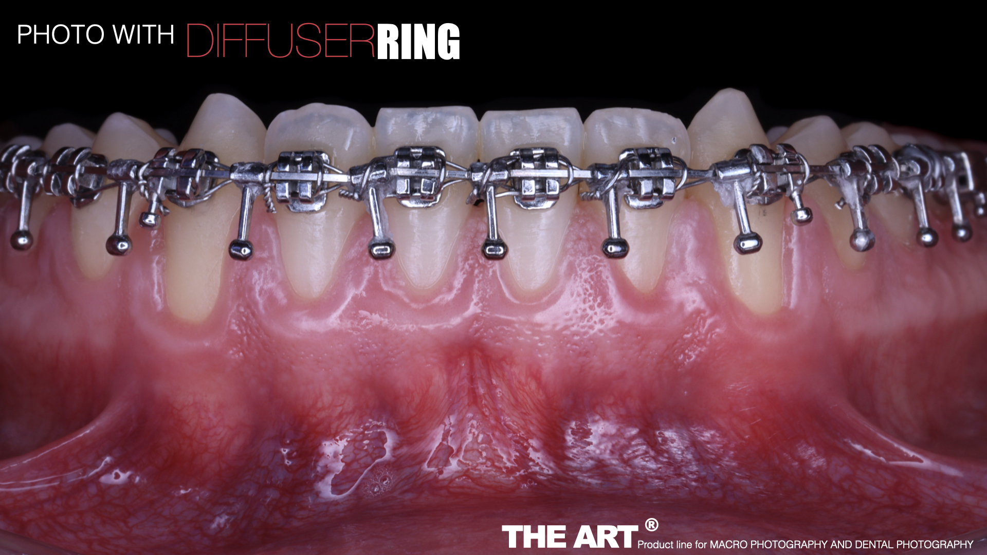 The Art®️ Diffuser Ring V.2 - Imagen 9