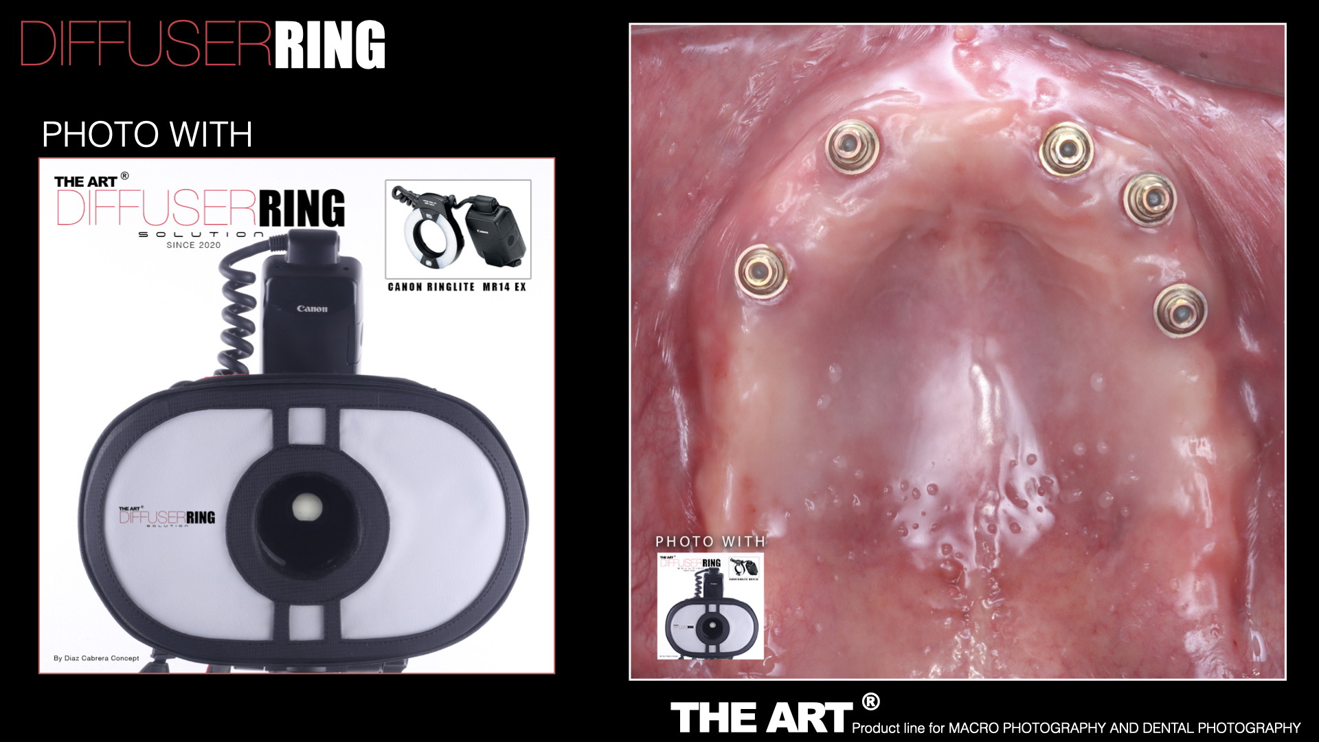 The Art®️ Diffuser Ring V.2 - Imagen 11