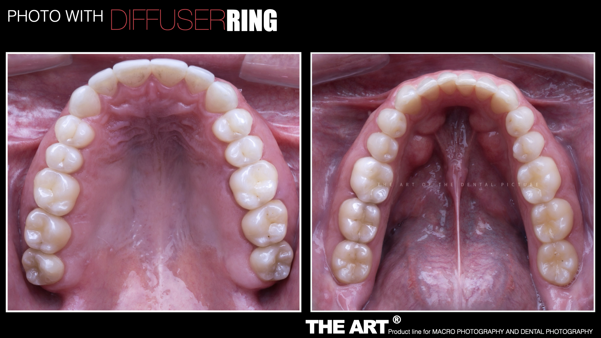 The Art®️ Diffuser Ring V.2 - Imagen 12